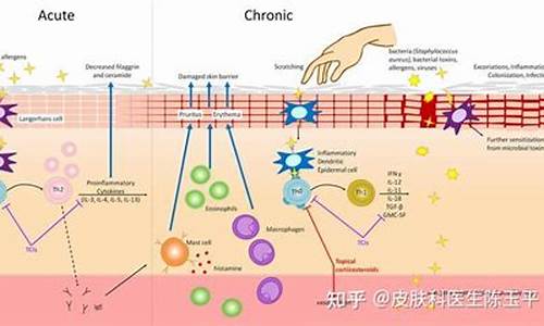 白癜风病理机制有哪些_白颠疯病病理